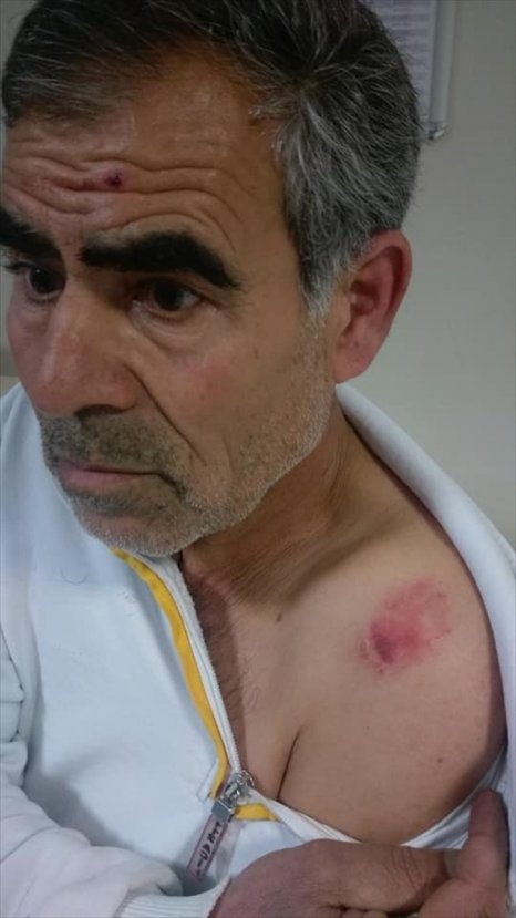 Şanlıurfa'da sağlık çalışanları darbedildi