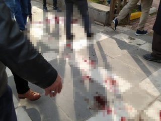Viranşehir’de park yeri kavgasında 7 kişi yaralandı